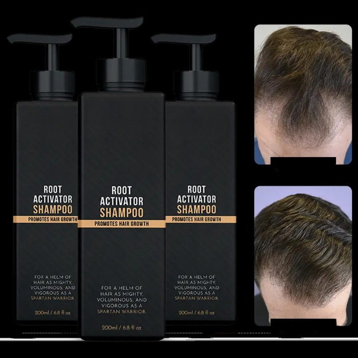 Root Activating Shampoo™